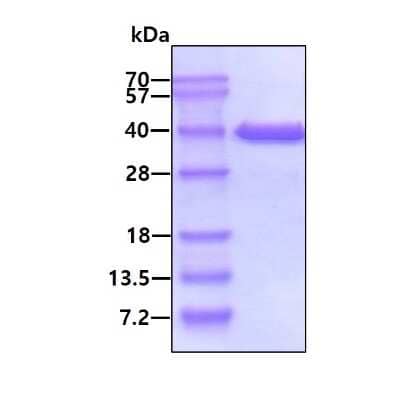 SDS-PAGE: Recombinant Human MDH1 His Protein [NBP1-45315]